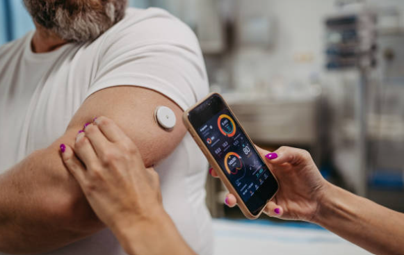Continuous glucose monitor sensor on the arm with readings shown on a phone